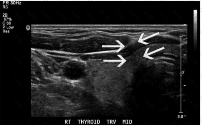 AB-Abdomen Question 25