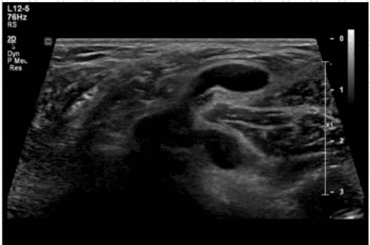 AB-Abdomen Question 47