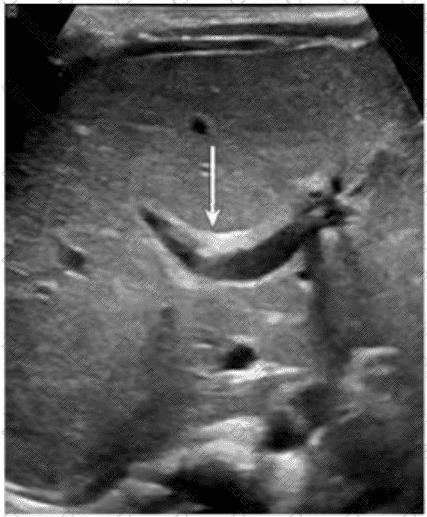 AB-Abdomen Question 36