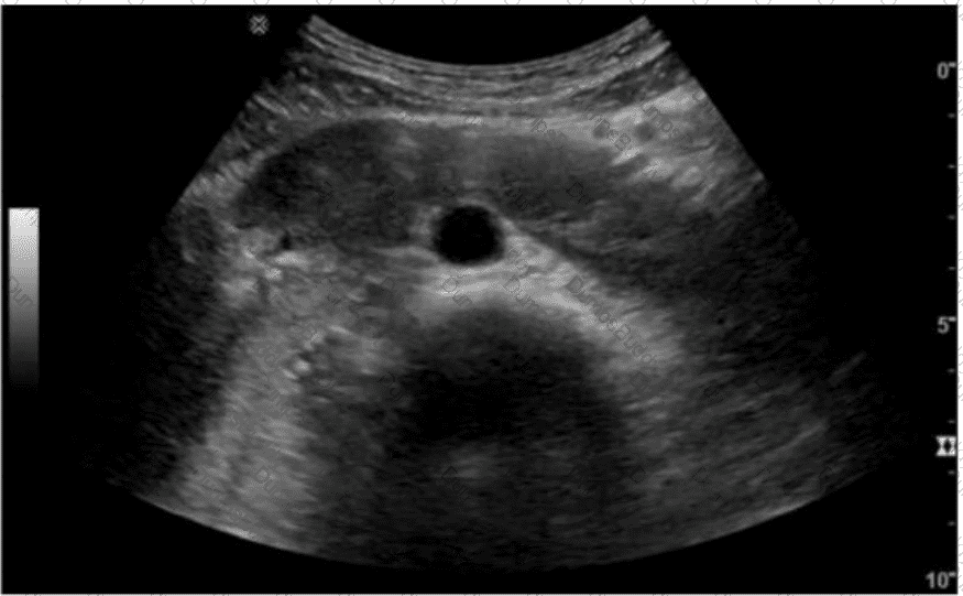 AB-Abdomen Question 5