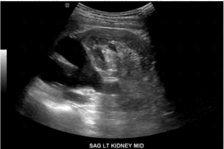 AB-Abdomen Question 17