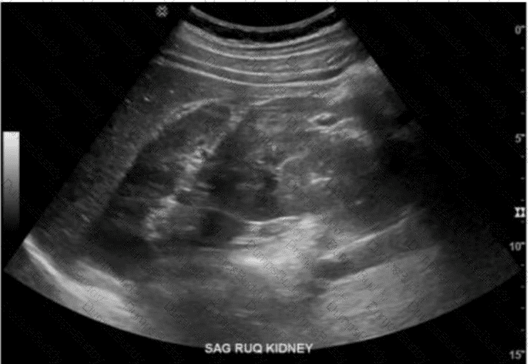 AB-Abdomen Question 15