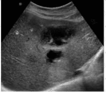 AB-Abdomen Question 4