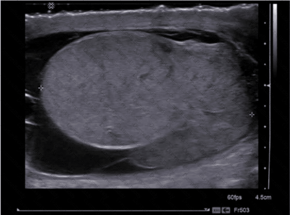 AB-Abdomen Question 13