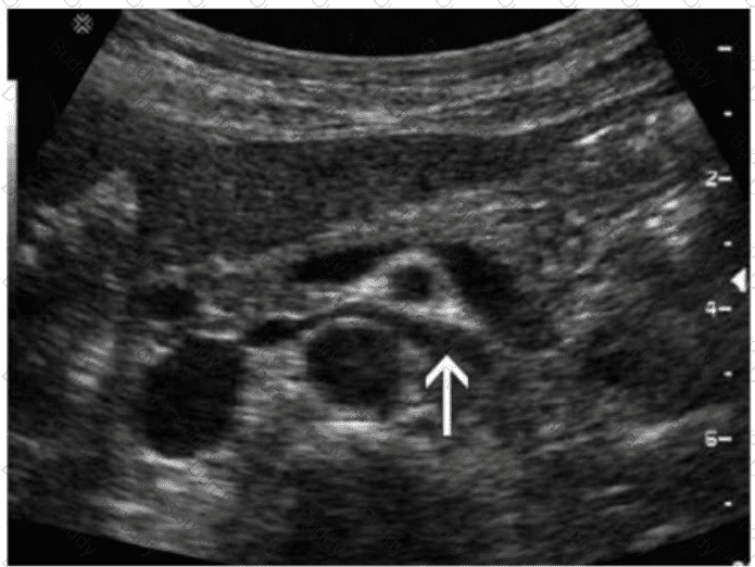 AB-Abdomen Question 23