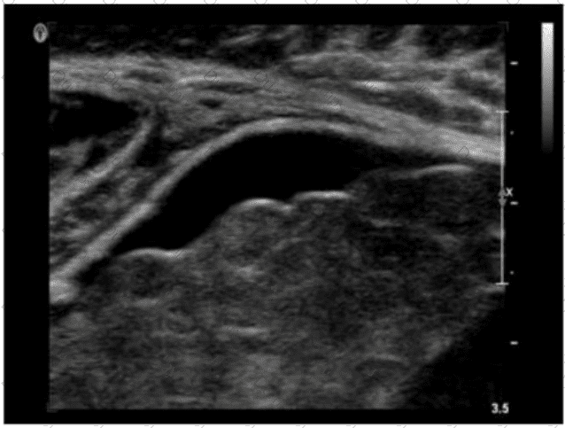 AB-Abdomen Question 12