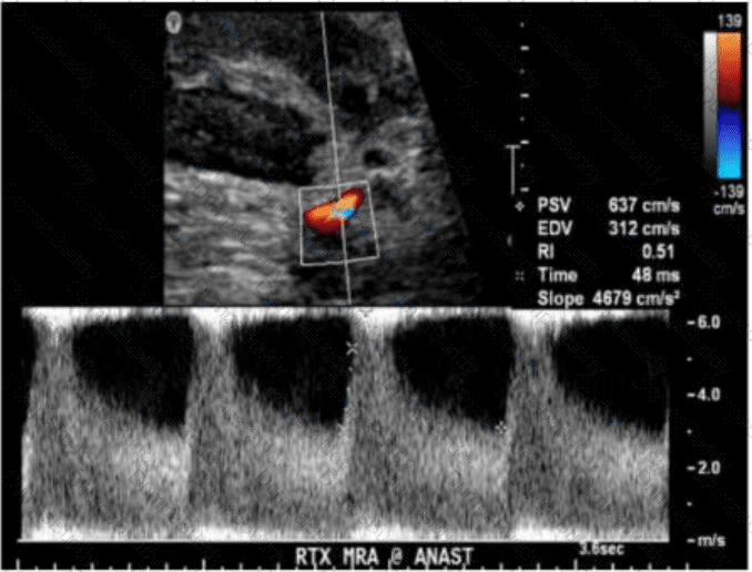 AB-Abdomen Question 10
