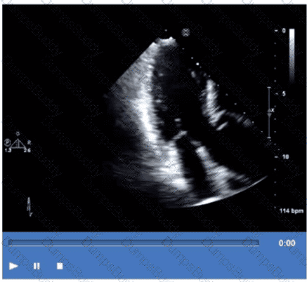 AE-Adult-Echocardiography Question 33