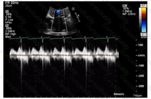 AE-Adult-Echocardiography Question 23