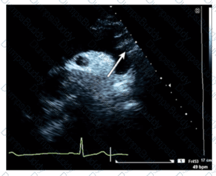AE-Adult-Echocardiography Question 4