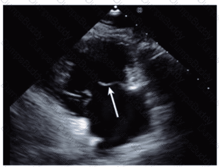AE-Adult-Echocardiography Question 30