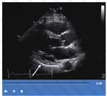 AE-Adult-Echocardiography Question 27