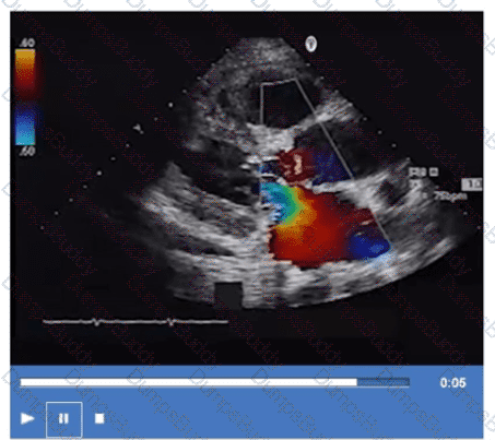 AE-Adult-Echocardiography Question 29