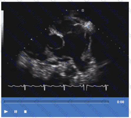AE-Adult-Echocardiography Question 7