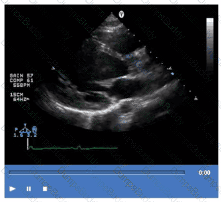 AE-Adult-Echocardiography Question 8