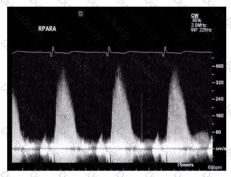 AE-Adult-Echocardiography Question 34