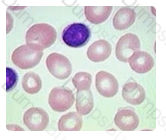 ASCP-MLT Question 74
