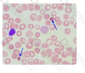 ASCP-MLT Question 58