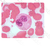 ASCP-MLT Question 80