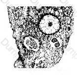 ASCP-MLT Question 37