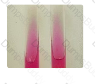 ASCP-MLT Question 30