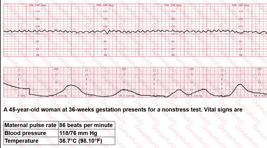 EFM Question 22